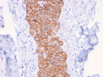 HER2 Antibody / ErbB2