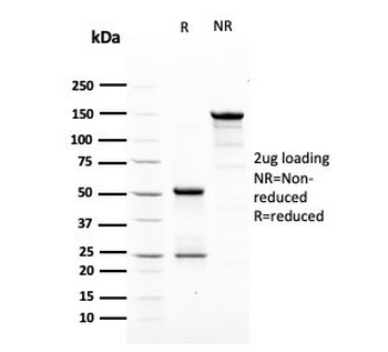 HER2 Antibody / ErbB2