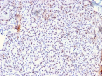 AKT1 Antibody