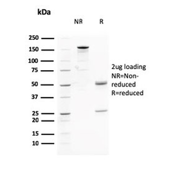 AKT1 Antibody