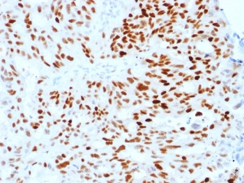 Estrogen Receptor alpha Antibody