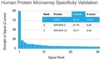 Estrogen Receptor alpha Antibody