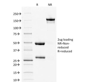 Estrogen Receptor alpha Antibody