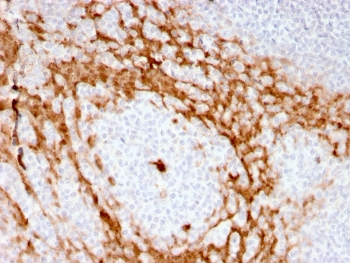Recombinant GCSF Antibody / Granulocyte-Colony Stimulating Factor