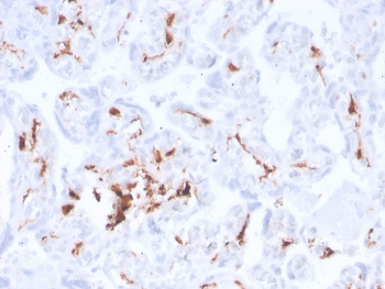 Factor XIIIa Antibody / F13A1