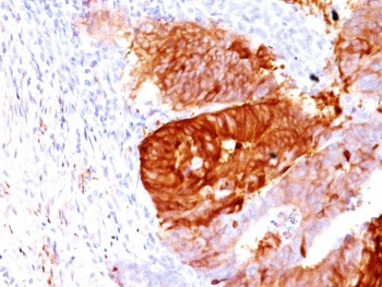 ALDH1A1 Antibody / Acetaldehyde dehydrogenase 1