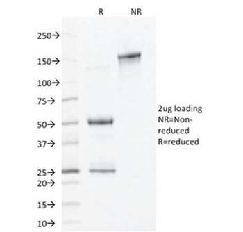 ALDH1A1 Antibody / Acetaldehyde dehydrogenase 1