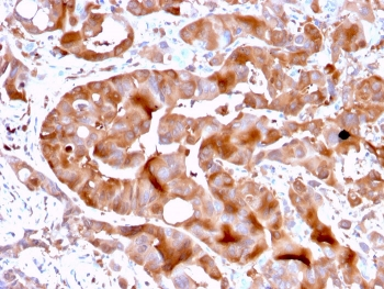 FABP5 Antibody (epidermal)
