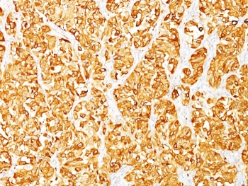 MART-1 Antibody Cocktail / Melan-A