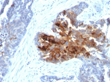 Recombinant TAG-72 Antibody