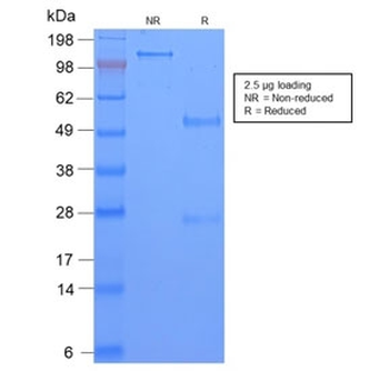 Recombinant TAG-72 Antibody