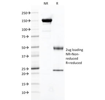FOLH1 Antibody / Folate Hydrolase 1