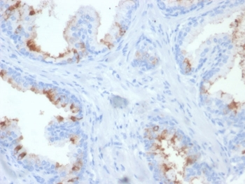 Folate Hydrolase 1 Antibody / FOLH1 / PSMA
