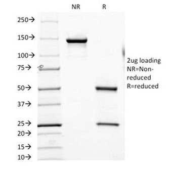 Folate Hydrolase 1 Antibody / FOLH1 / PSMA