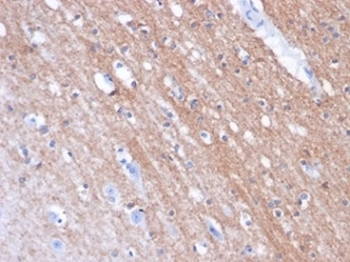 Folate Hydrolase 1 Antibody / FOLH1 / PSMA