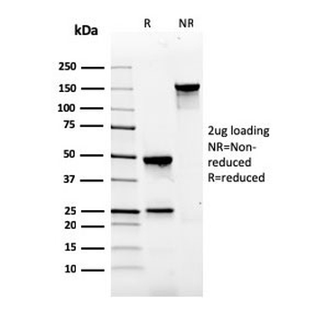 Gastrin Antibody