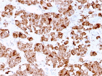Growth Hormone Antibody / GH1