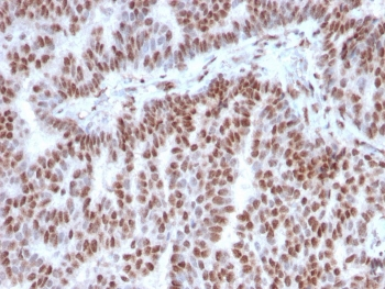 Estrogen Receptor alpha Antibody