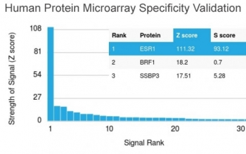 Estrogen Receptor alpha Antibody