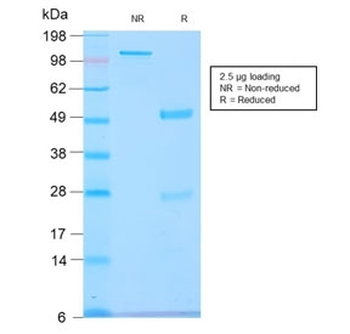 Recombinant GNRHR / LHCGR Antibody