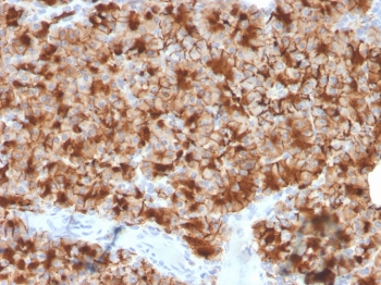 Glycoprotein 2 Antibody / GP2 / ZAP75