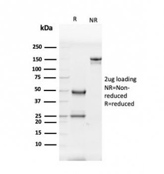 Glycoprotein 2 Antibody / GP2 / ZAP75