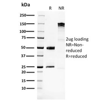 Glucose 6-Phosphate Isomerase Antibody / GPI