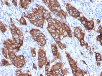 HER2 Antibody / ErbB2