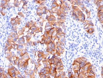 HER2 Antibody / ErbB2