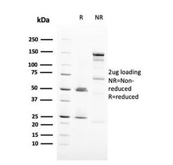HER2 Antibody / ErbB2
