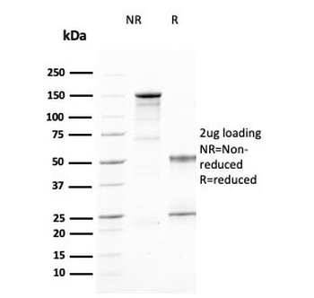CD25 Antibody / IL2RA