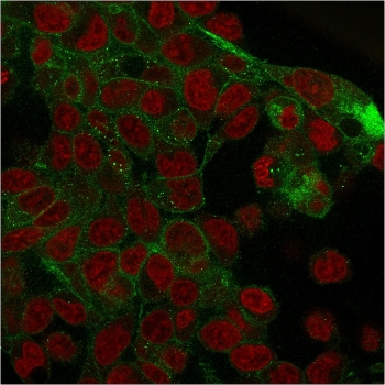 Gamma Catenin Antibody / Plakoglobin