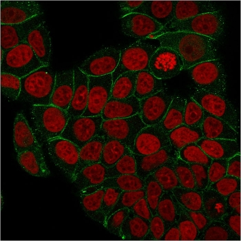 Gamma Catenin Antibody / Plakoglobin
