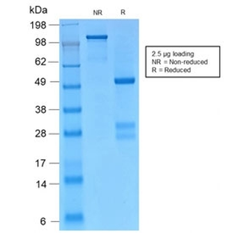 Recombinant Catenin gamma Antibody / Plakoglobin