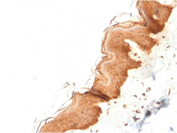 Cytokeratin 4 Antibody / KRT4