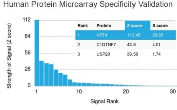 Cytokeratin 4 Antibody / KRT4
