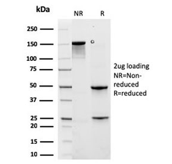 Recombinant Cytokeratin 6A Antibody