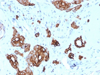 KRT7 Antibody / Cytokeratin 7