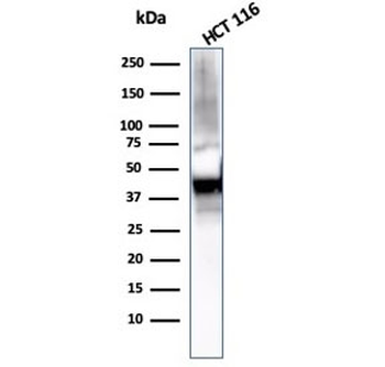 KRT8 Antibody / Cytokeratin 8