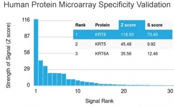 KRT8 Antibody / Cytokeratin 8