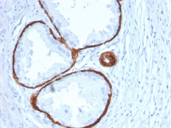 Cytokeratin 14 Antibody / CK14 / KRT14