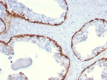 KRT15 Antibody / Cytokeratin 15