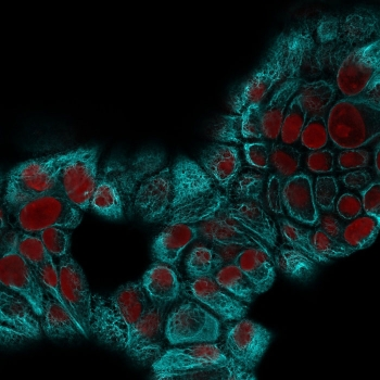 KRT15 Antibody / Cytokeratin 15