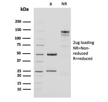 KRT15 Antibody / Cytokeratin 15