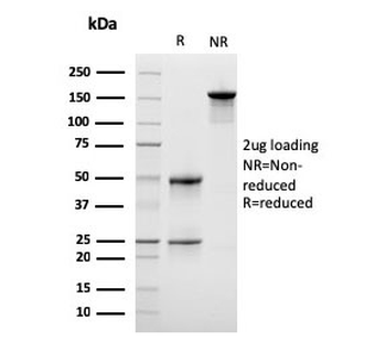 LSP1 Antibody / Lymphocyte Specific Protein 1