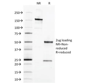 EpCAM Antibody