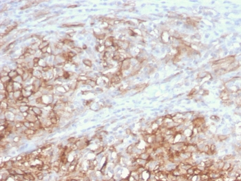 CD146 Antibody / MCAM / MUC18