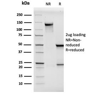 CD146 Antibody / MCAM / MUC18