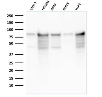 Recombinant MCM7 Antibody