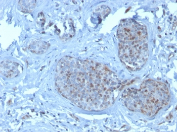 MDM2 Antibody